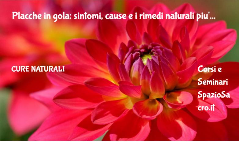 Placche in gola: sintomi, cause e i rimedi naturali piu' efficaci 1 Placche In Gola: Sintomi, Cause E I Rimedi Naturali Piu' Efficaci