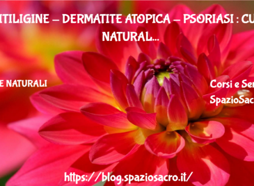 Vitiligine Dermatite Atopica Psoriasi : Cure Naturali