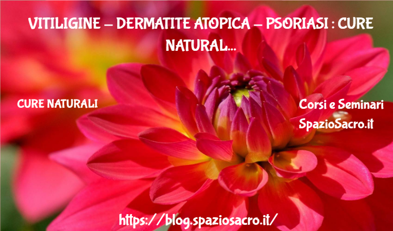 Vitiligine Dermatite Atopica Psoriasi : Cure Naturali